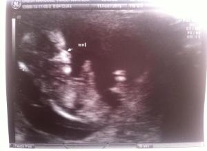 10818527_743092099103858_787831439_n