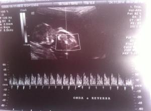 10818658_743089455770789_1467722925_n