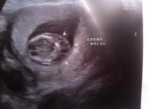 10822566_743089402437461_116104953_n